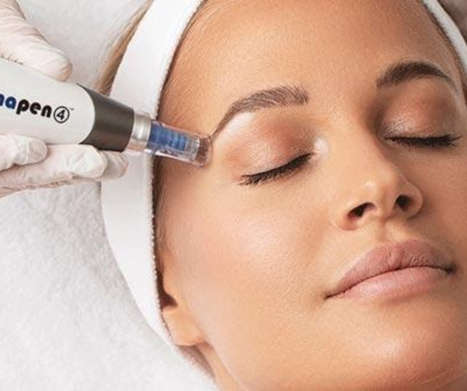 Dermapen (Microneedling)